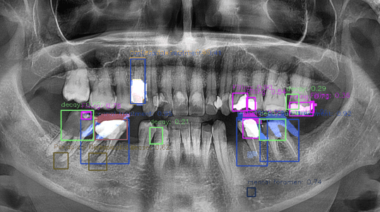Dental AI